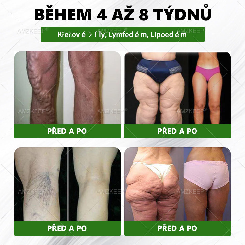 𝐋é𝐤𝐚ř𝐞𝐦 𝐟𝐨𝐫𝐦𝐮𝐥𝐨𝐯𝐚𝐧ý 𝐀𝐌𝐙𝐊𝐄𝐄𝐏® Green