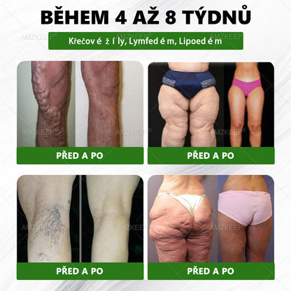 𝐋é𝐤𝐚ř𝐞𝐦 𝐟𝐨𝐫𝐦𝐮𝐥𝐨𝐯𝐚𝐧ý 𝐀𝐌𝐙𝐊𝐄𝐄𝐏® Green